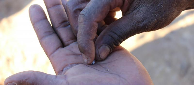 Young miner in Zimbabwe shows mercury coated gold